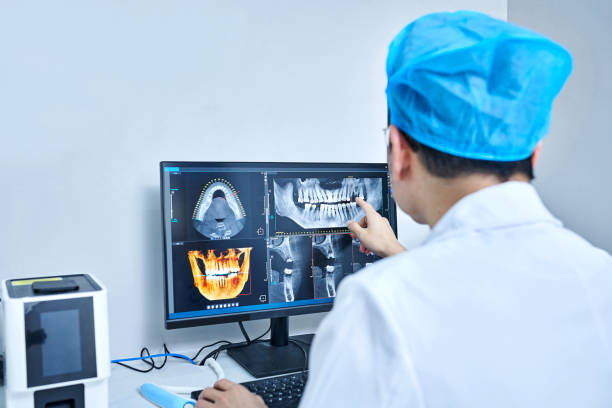 Best Knocked-Out Tooth (Avulsed Tooth) Treatment in Indian Trail, NC